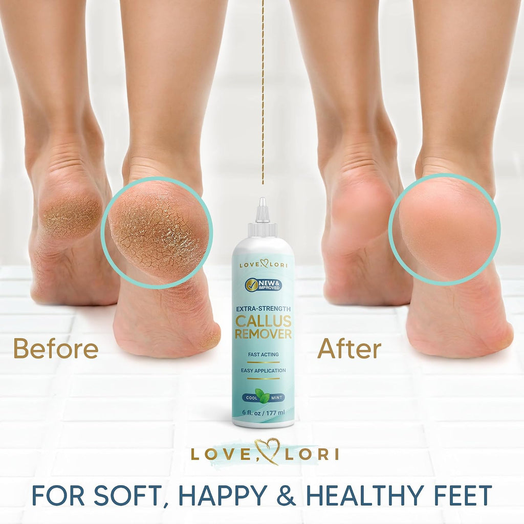 Extra Strength Foot Callus Remover Gel, 6 oz - Alternate angle