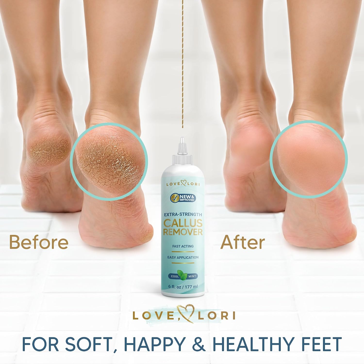 Extra Strength Foot Callus Remover Gel, 6 oz - Alternate angle
