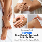 Ebanel Urea 40% Cream for Cracked Feet - Close-up