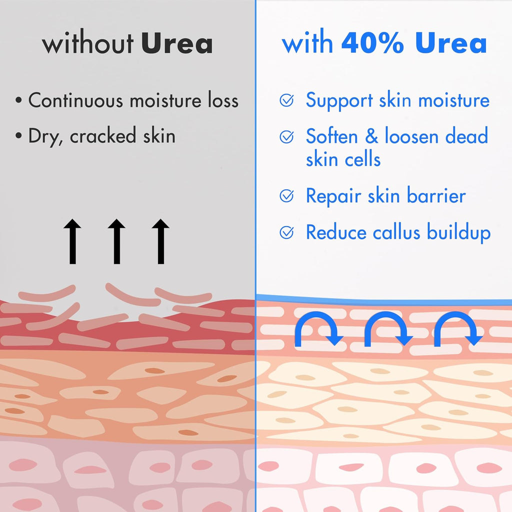 Ebanel Urea 40% Cream for Cracked Feet - Size reference