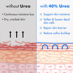 Ebanel Urea 40% Cream for Cracked Feet - Size reference