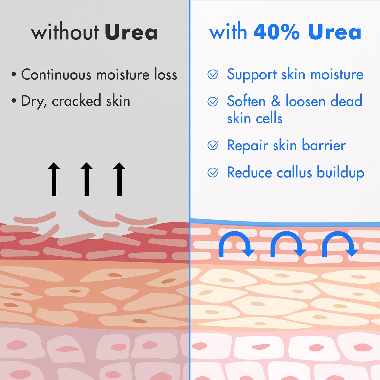 Ebanel Urea 40% Cream for Cracked Feet - Size reference